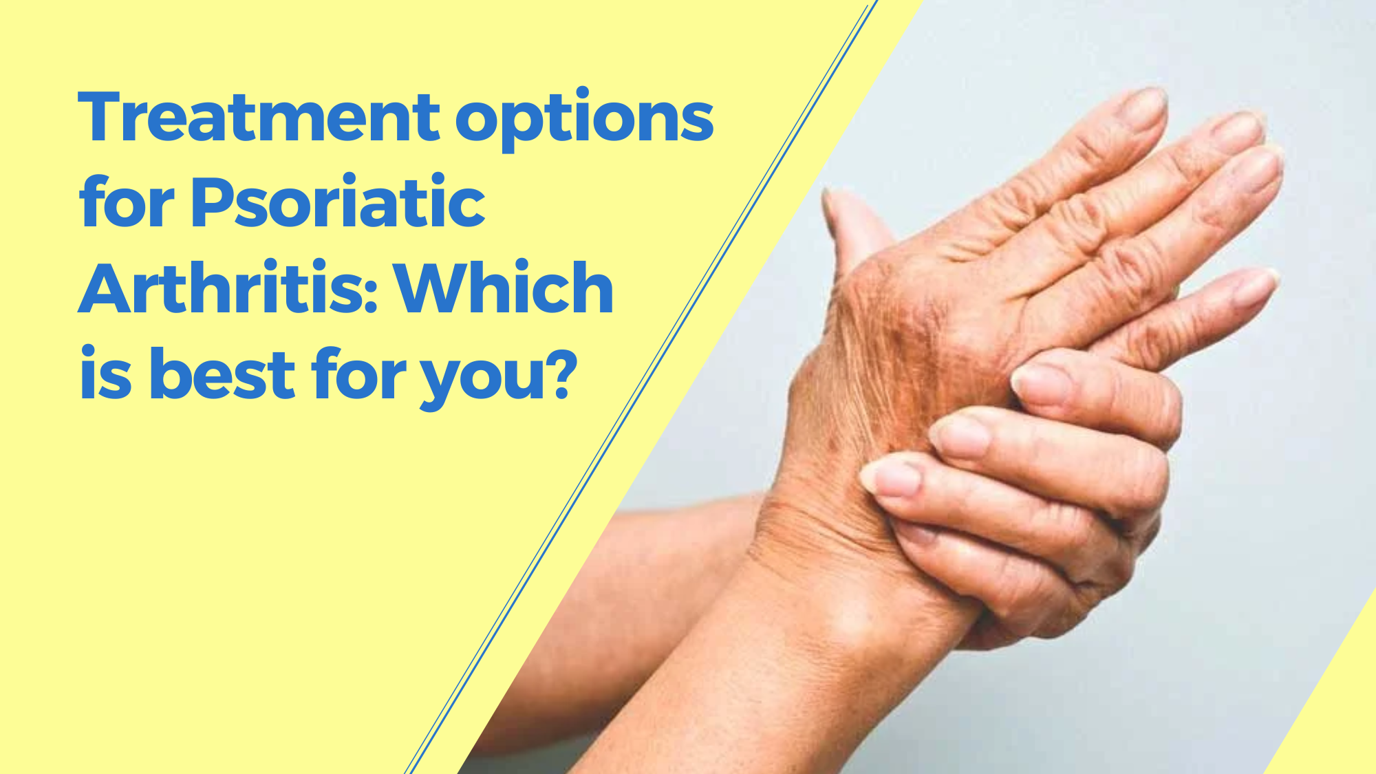 Treatment options for psoriatic arthritis: which is best for you?